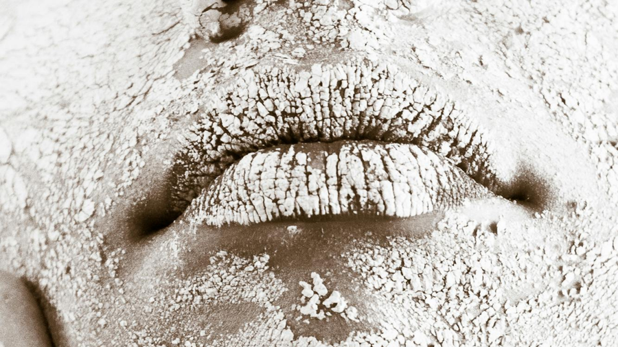 7 Tips for Taking Care of Dry Skin in Winter