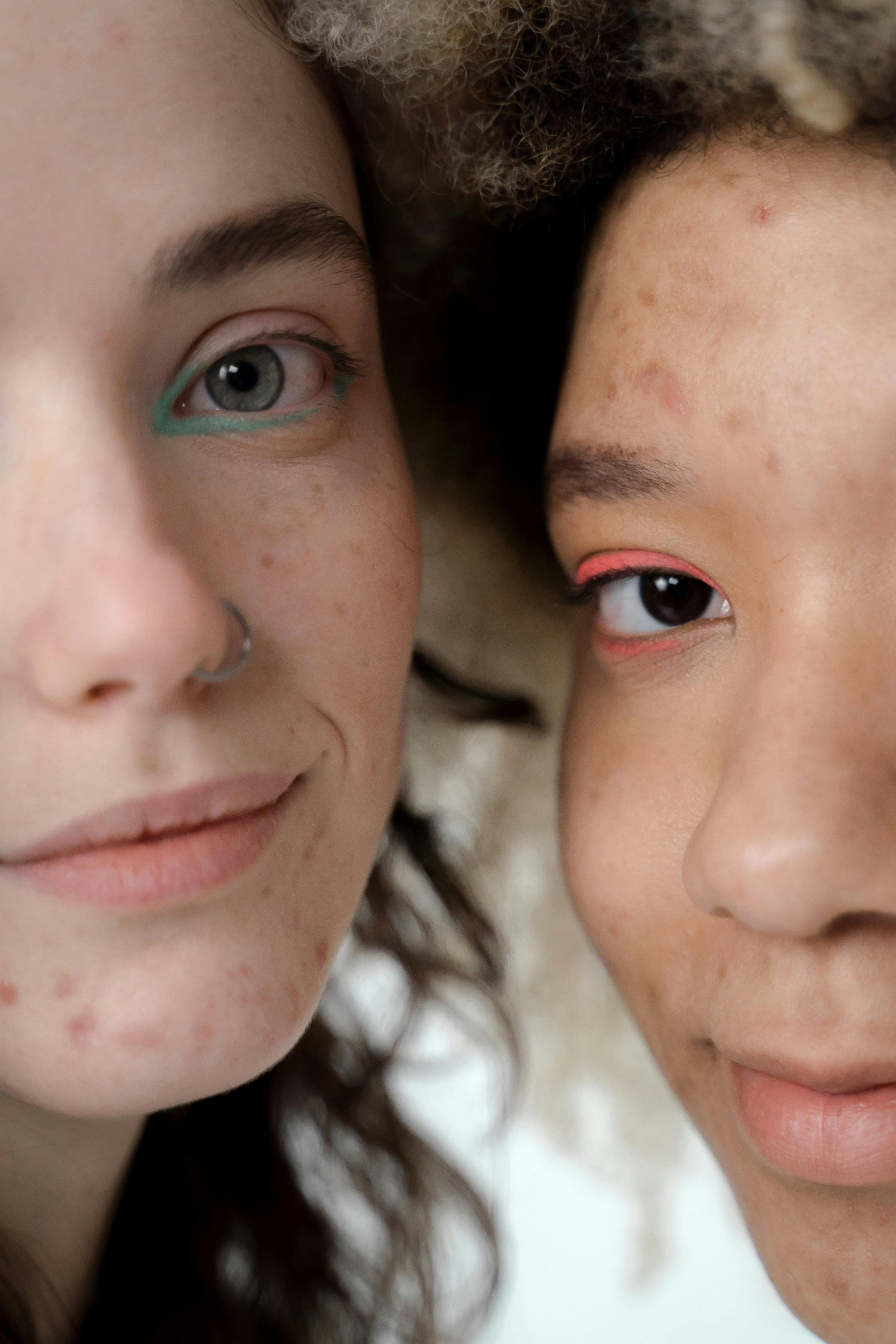 How to Treat Post Inflammatory Hyperpigmentation Without Irritating Skin